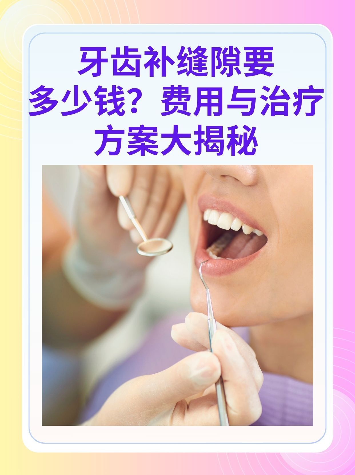 岳阳补牙医保可以报销吗(补牙医保可以报销吗 哪些可以报销呢)